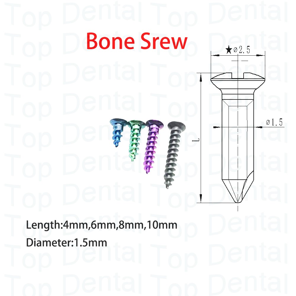 10 adet Diş GBR Sistemi Kemik  - Stabilizer Screw In incelemesi ve fiyatı